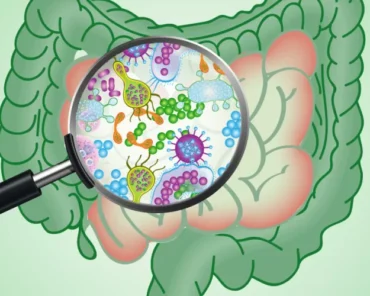 SIBO: o que é, sintomas, diagnóstico e tratamento