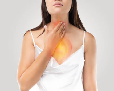 Refluxo Gastroesofágico (DRGE): o que é, sintomas, causas e como tratar